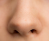 Hemorragia Nasal