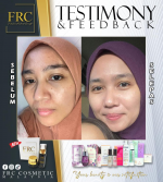 TESTIMONI - FABELA SKINCARE SELESAIKAN MASALAH KULIT WAJAH ANDA