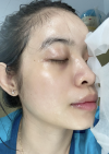 [ TIPS] SKINCARE ROUTION FOR ANCE