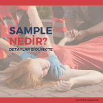 SAMPLE Nedir?