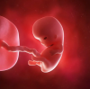 Fetus DISCORD