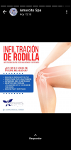 Aplicación de plasma rico en plaquetas en rodilla