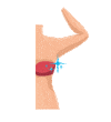 $169 for 12 Months Underarm SHR