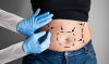 Safe, Effective, and Long-Term Solutions With Cosmetic Surgery in the Detroit Metropolitan Area