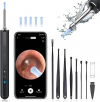 Ear Wax Removal