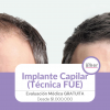 Implante capilar Tecnica FUE