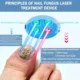 Nail Fungus Laser Treatment Device Repair Toenail Fingernail Fungus Treat Onychomycosis Laser Nails with Mushrooms Relaxation   4.9  16 Reviews  ౹  254 sold