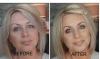 Are You Wanting to Prevent Anti-Aging? Click Here We Got You Covered.