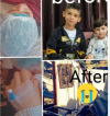 30. Help Amal - BFEP 1367