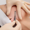 curso Online dermaplaning (tratamiento estético que exfolia)