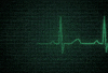 Nos examens cardiovasculaires